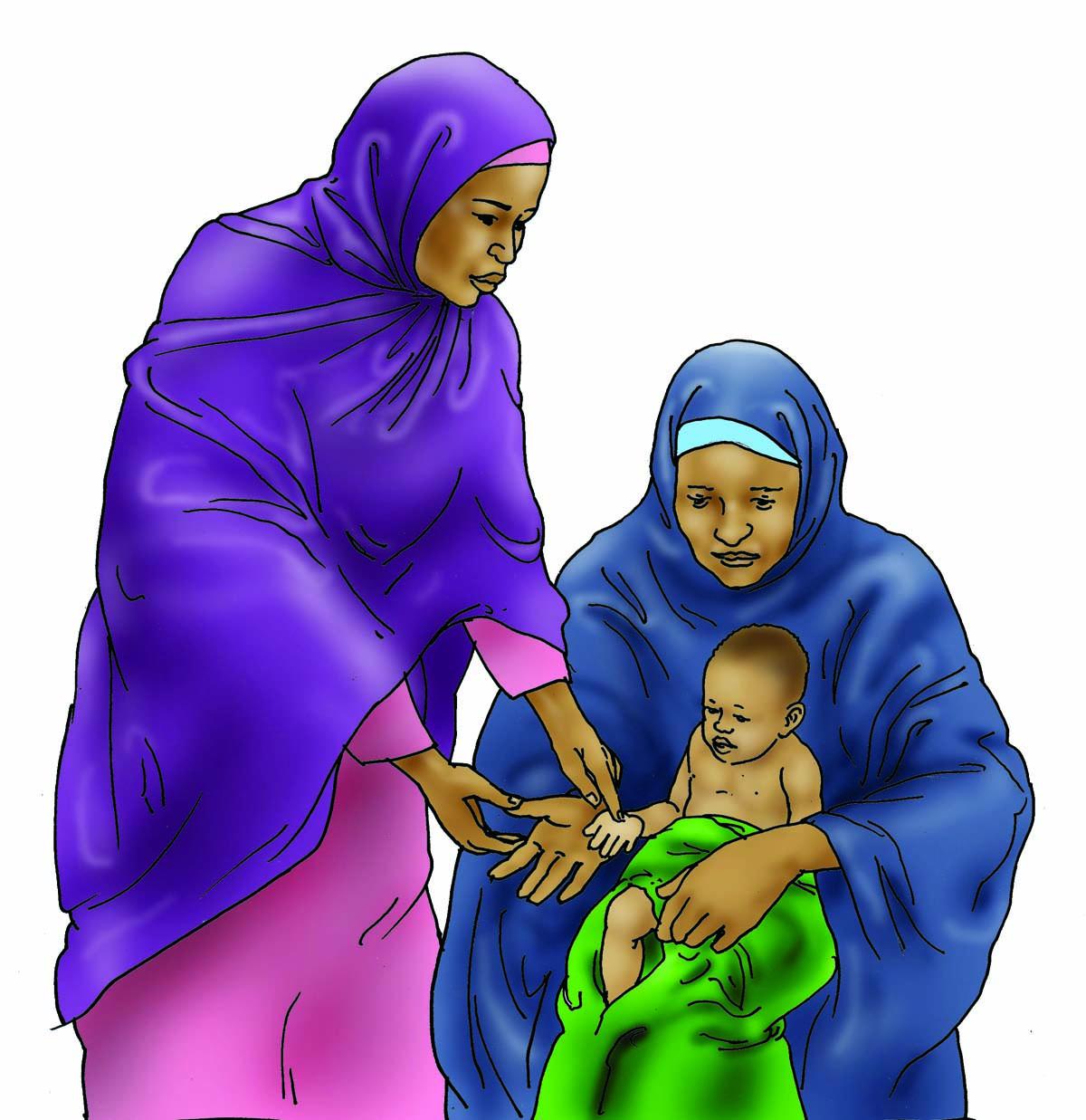 Sick baby health care - Signs of anemia for the baby 6-9 mo - 00 - Nigeria