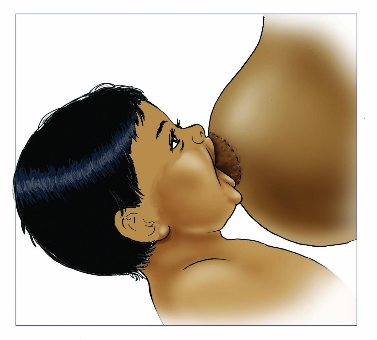 Breastfeeding - Breastfeeding good attachment outside 0-6 mo - 01 - India