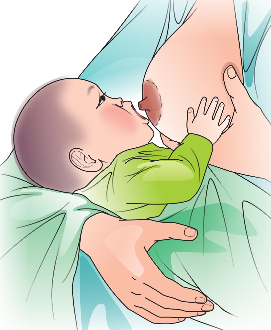 Breastfeeding - Breastfeeding pre-attachment 0-6 mo - 05 - Kyrgyz Republic