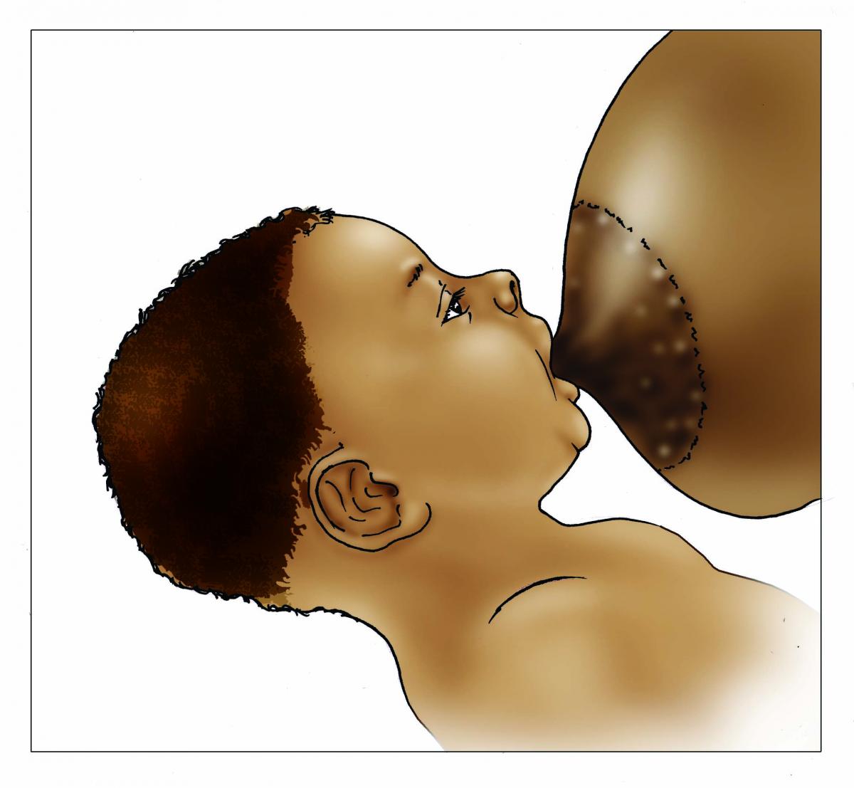Breastfeeding - Breastfeeding poor attachment outside 0-6 mo - 03A - Nigeria