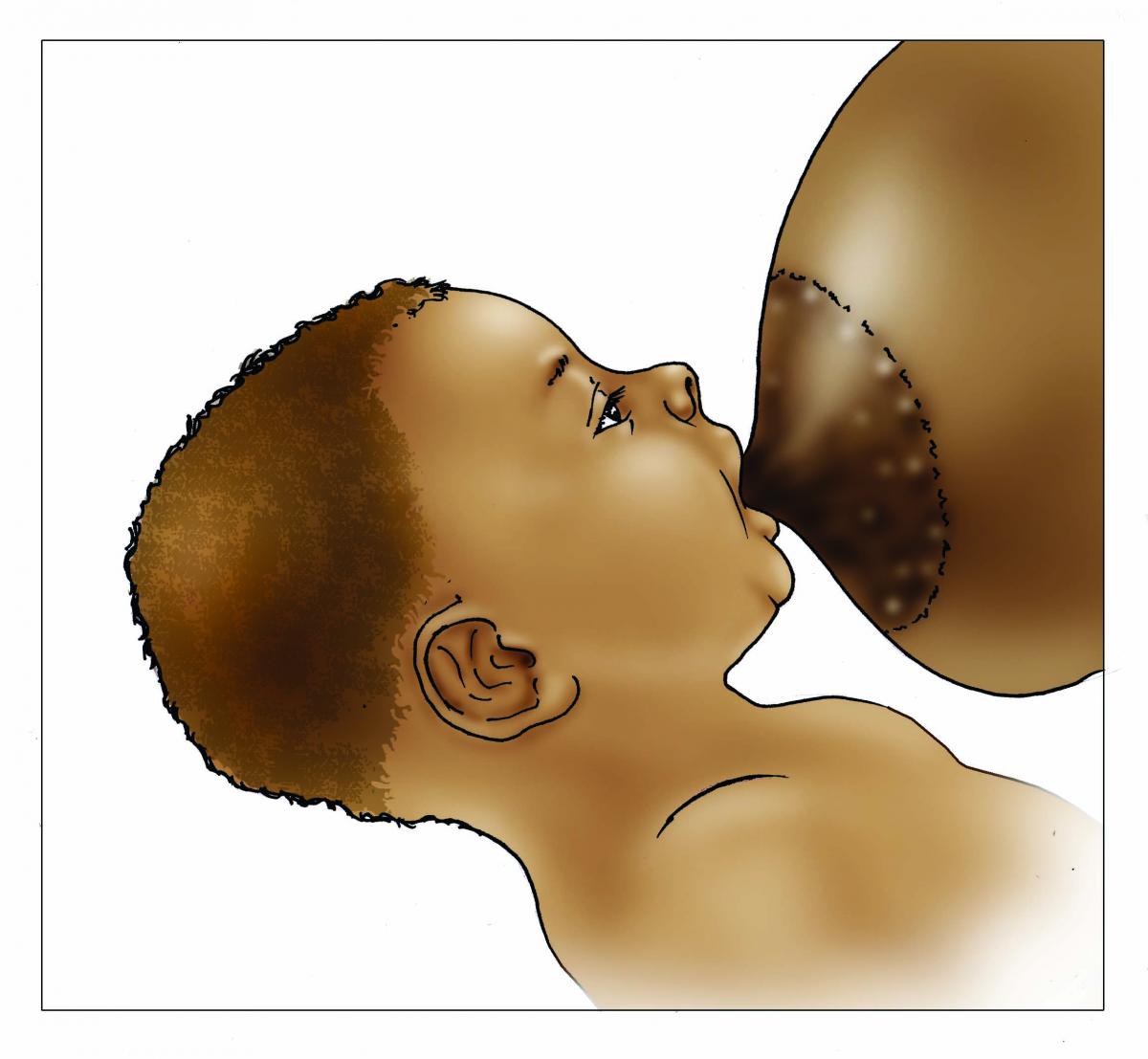 Breastfeeding - Breastfeeding poor attachment outside 0-6 mo - 03B - Nigeria