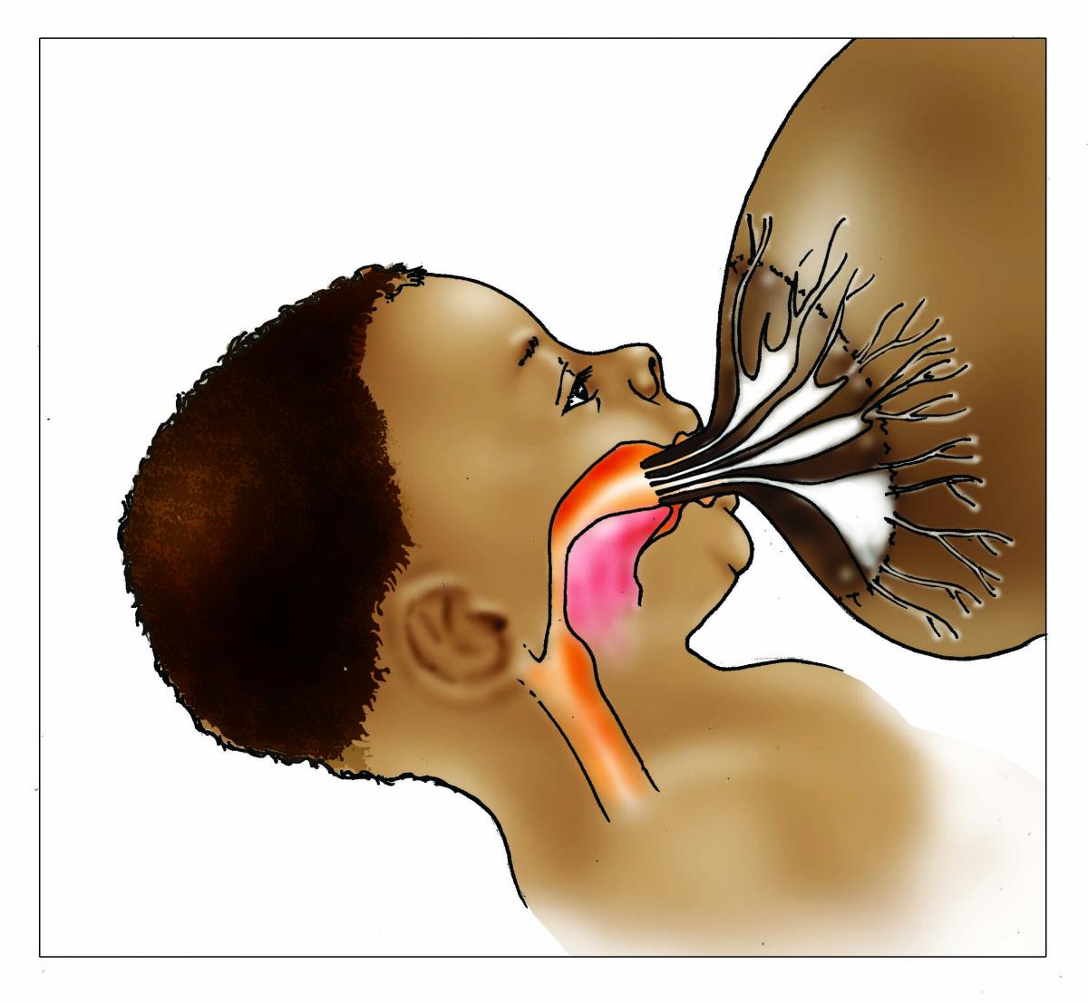 Breastfeeding - Breastfeeding poor attachment inside 0-6 mo - 04A - Nigeria