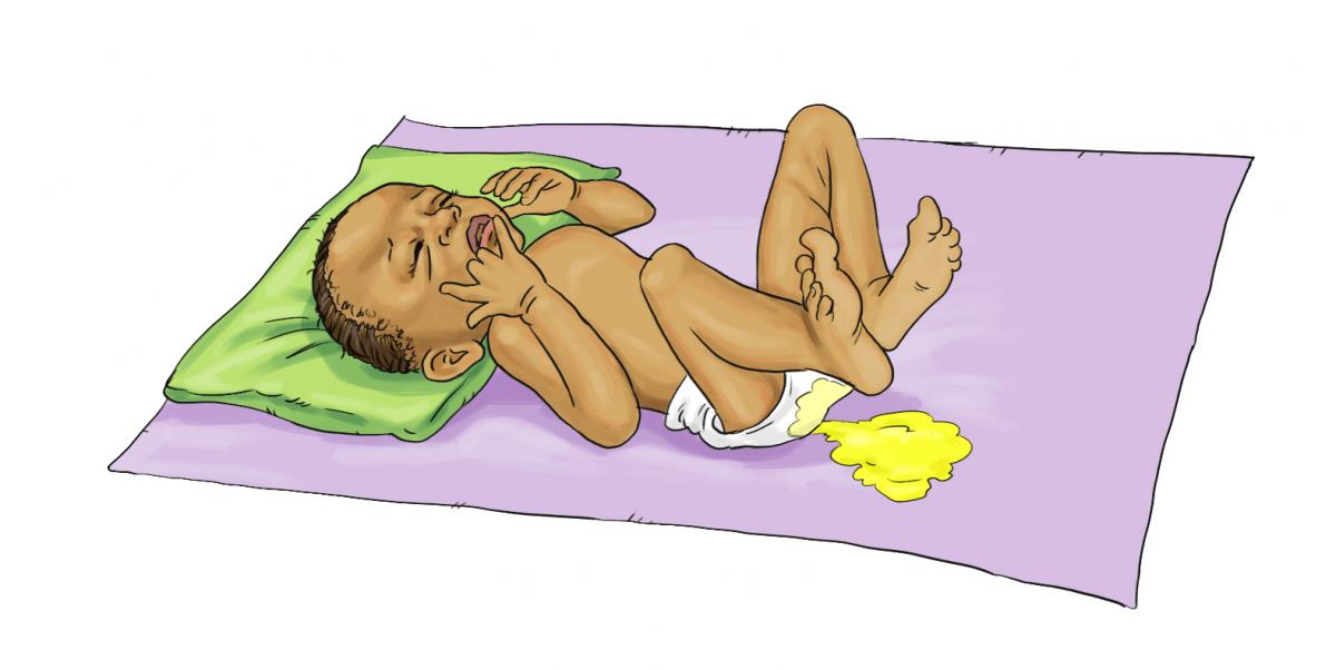 Breastfeeding - Baby with diarrhea 0-6mo - 02 - Burkina Faso Breastfeeding - Baby with diarrhea 0-6mo - 02 - Burkina Faso