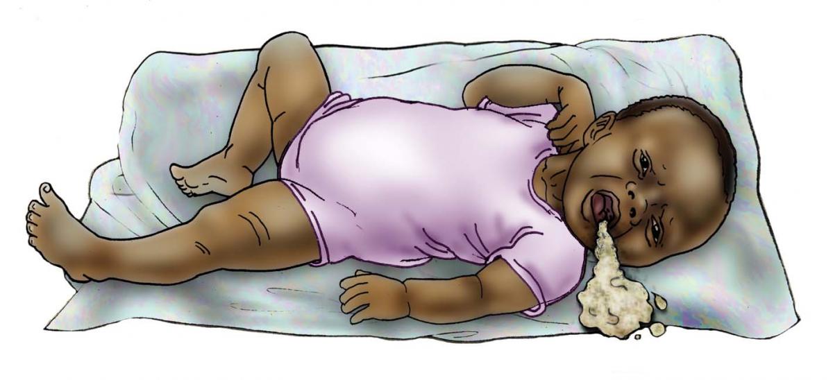 Sick Baby Health Care - Signs of sick baby - vomiting 0-6 mo - 01 - Non-country specific
