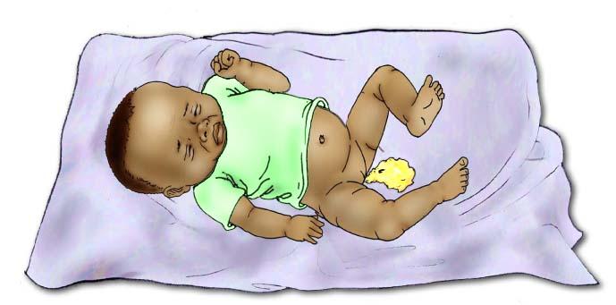 Sick Baby Health Care - Signs of sick baby- diarrhea 0-6 mo - 02 - Non-country specific