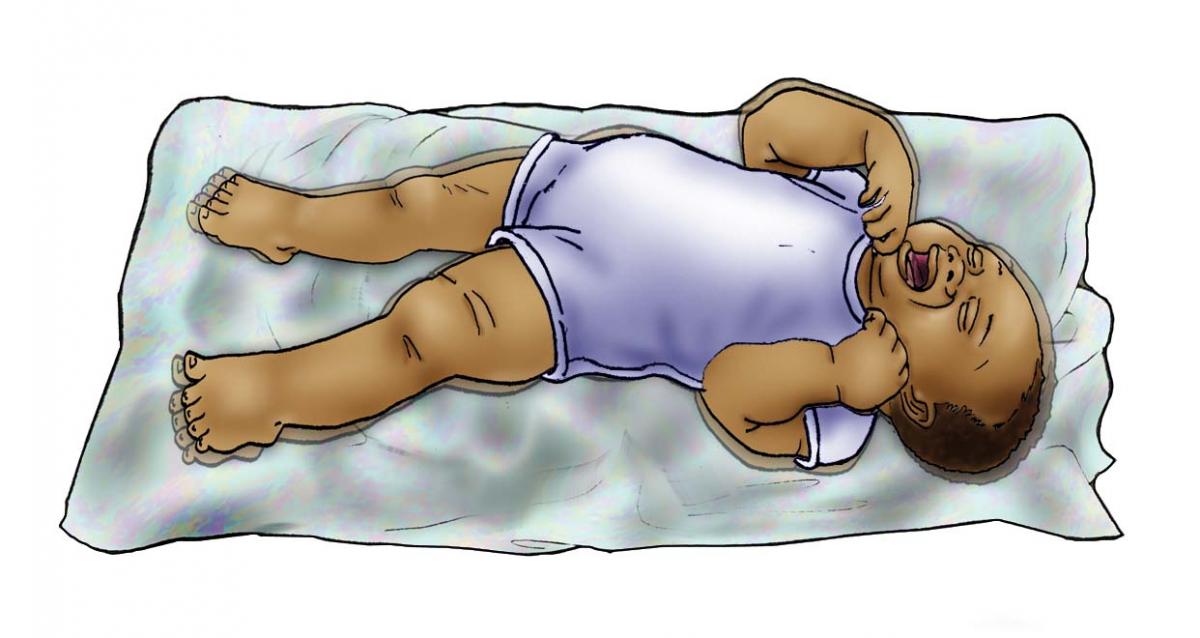Sick Baby Health Care - Signs of sick baby-convulsions 0-6 mo - 03C - Non-country specific