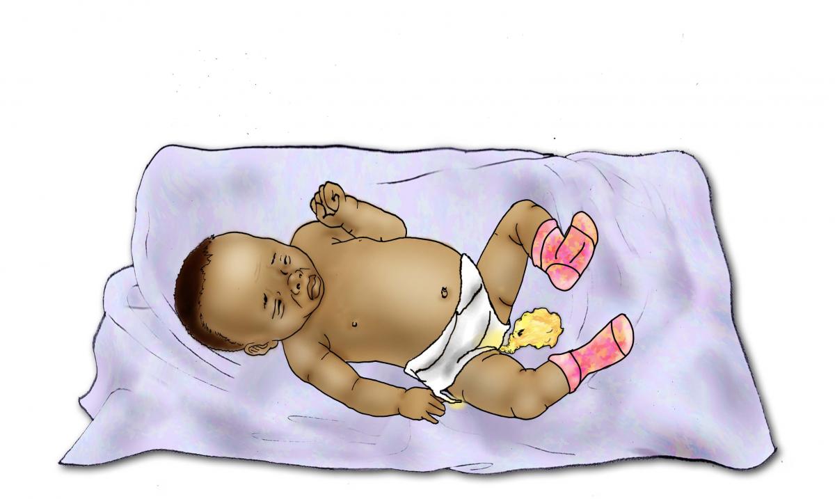 Sick Baby Health Care - Signs of sick baby- diarrhea 0-6 mo - 02 - Niger
