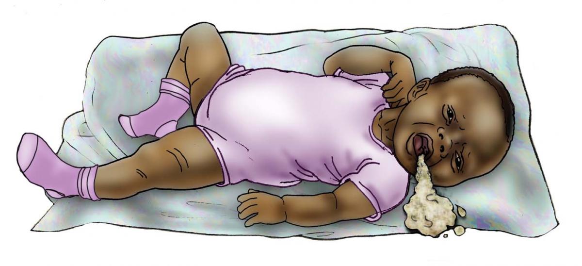 Sick Baby Health Care - Signs of sick baby - vomitting 0-6 mo - 01 - Nigeria