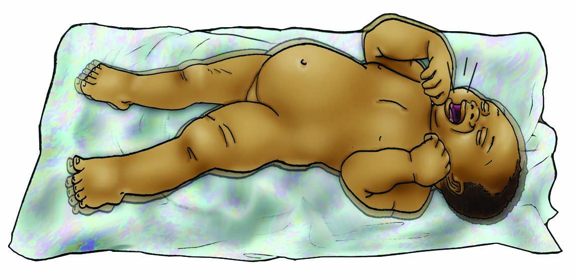 Sick Baby Health Care - Signs of sick baby - convulsions 0-6 mo - 03B - Nigeria
