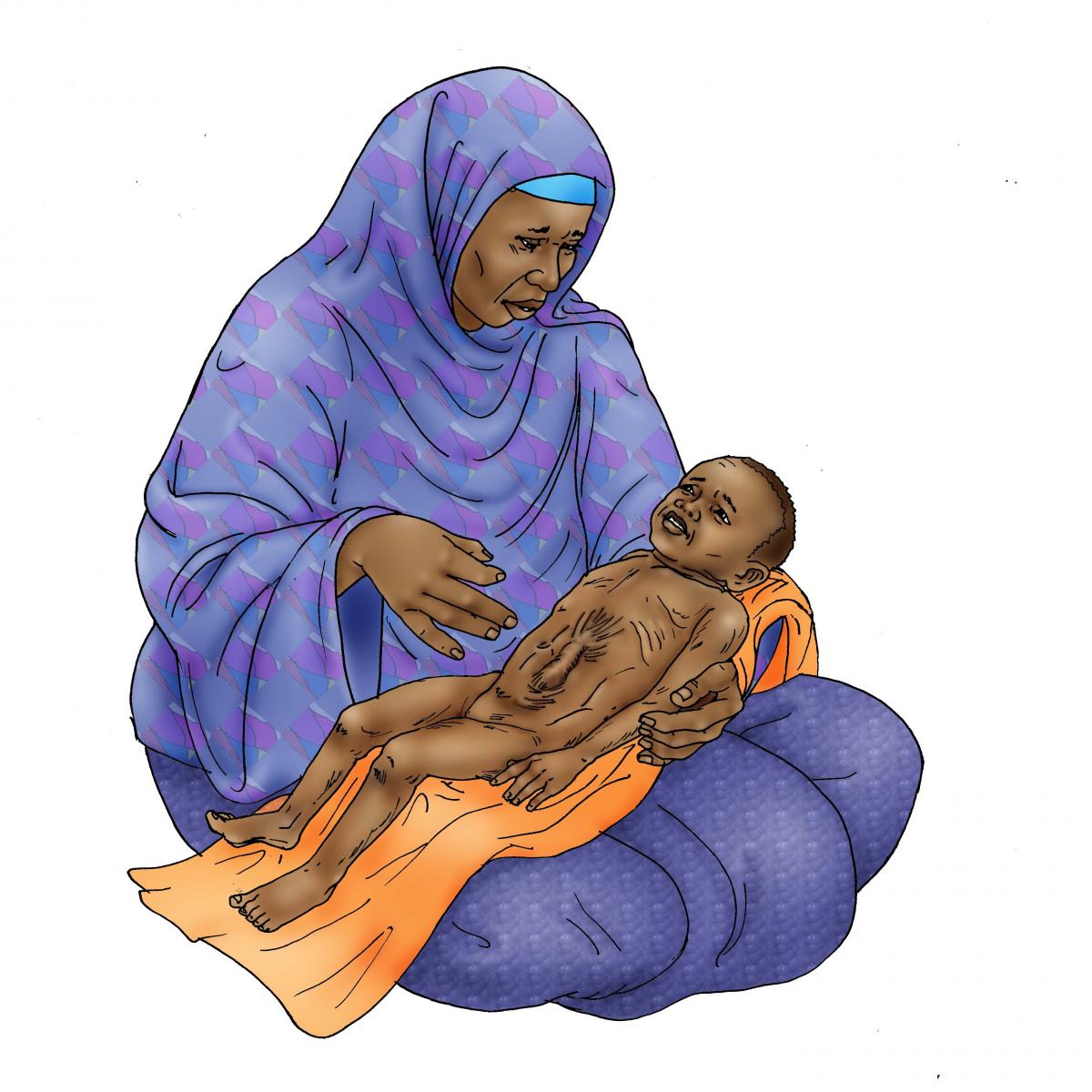 Sick Baby Nutrition - Dehydrated baby 6-24 mo - 04 - Niger