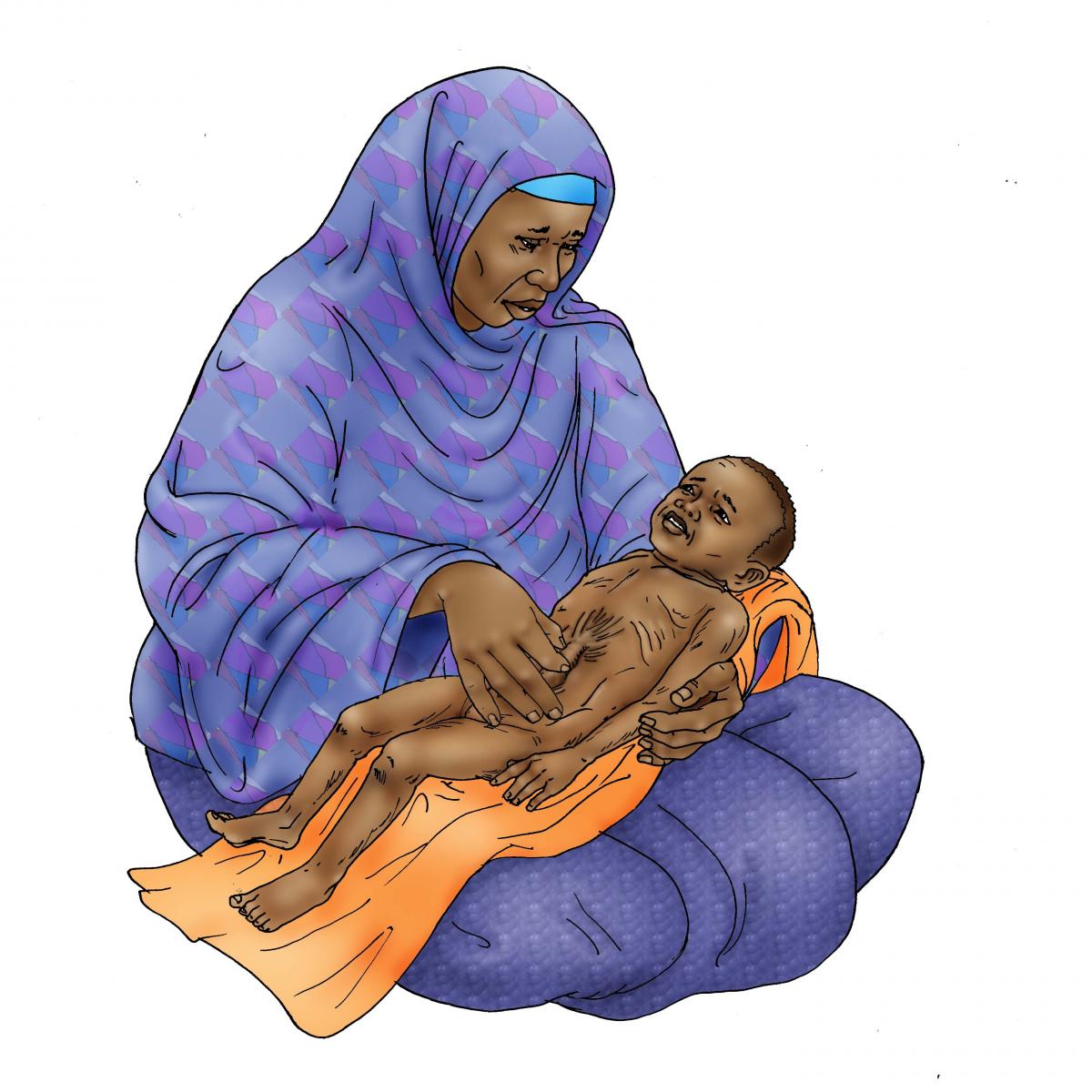 Sick Baby Nutrition - Dehydrated baby 6-24 mo - 05 - Niger
