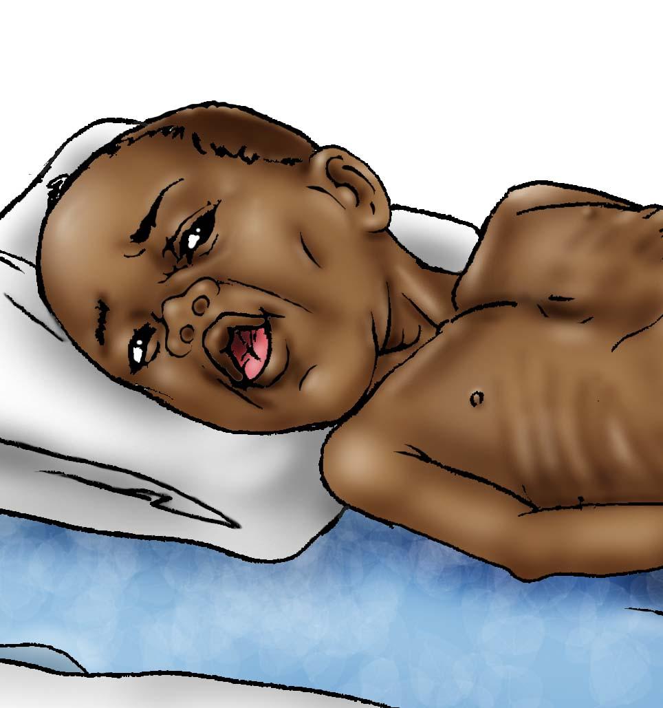 Sick Baby Health Care - Sick baby - respiratory distress 12-24 mo - 00 - Non-country specific