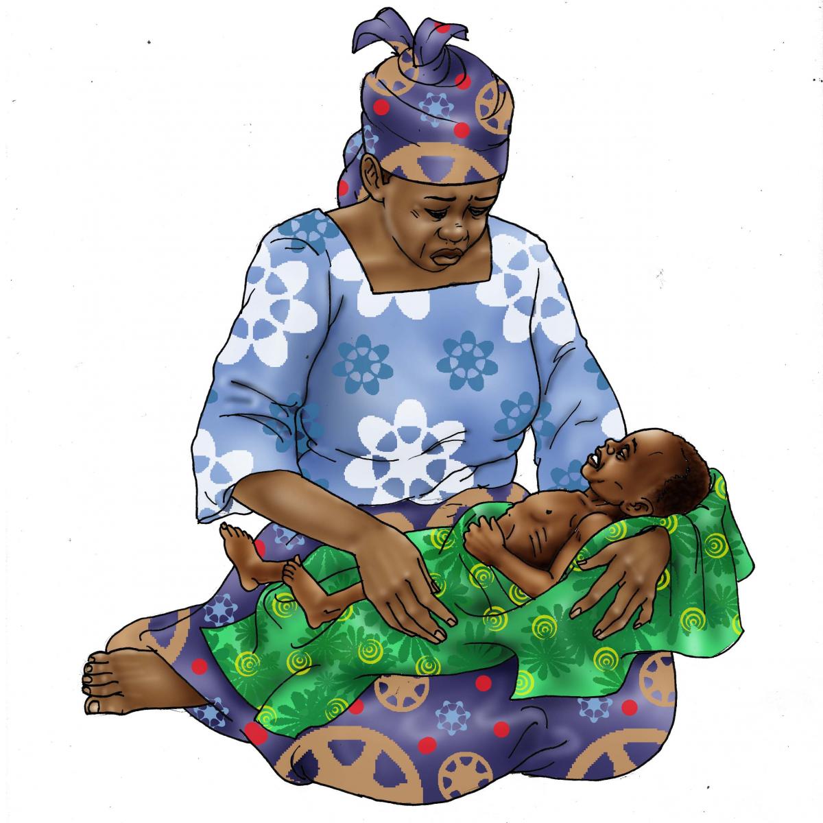 Sick Baby Health Care - Dehydrated and Malnourished baby 0-6 mo - 01 - Niger
