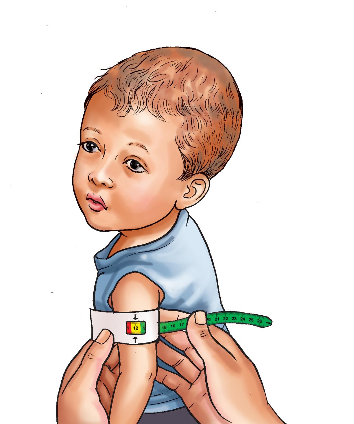 Sick Child Health - MUAC results - Moderate Acute Malnutrition 0-6mo - 04 - Nepal Sick Child Health - MUAC results - Moderate Acute Malnutrition 0-6mo - 04 - Nepal