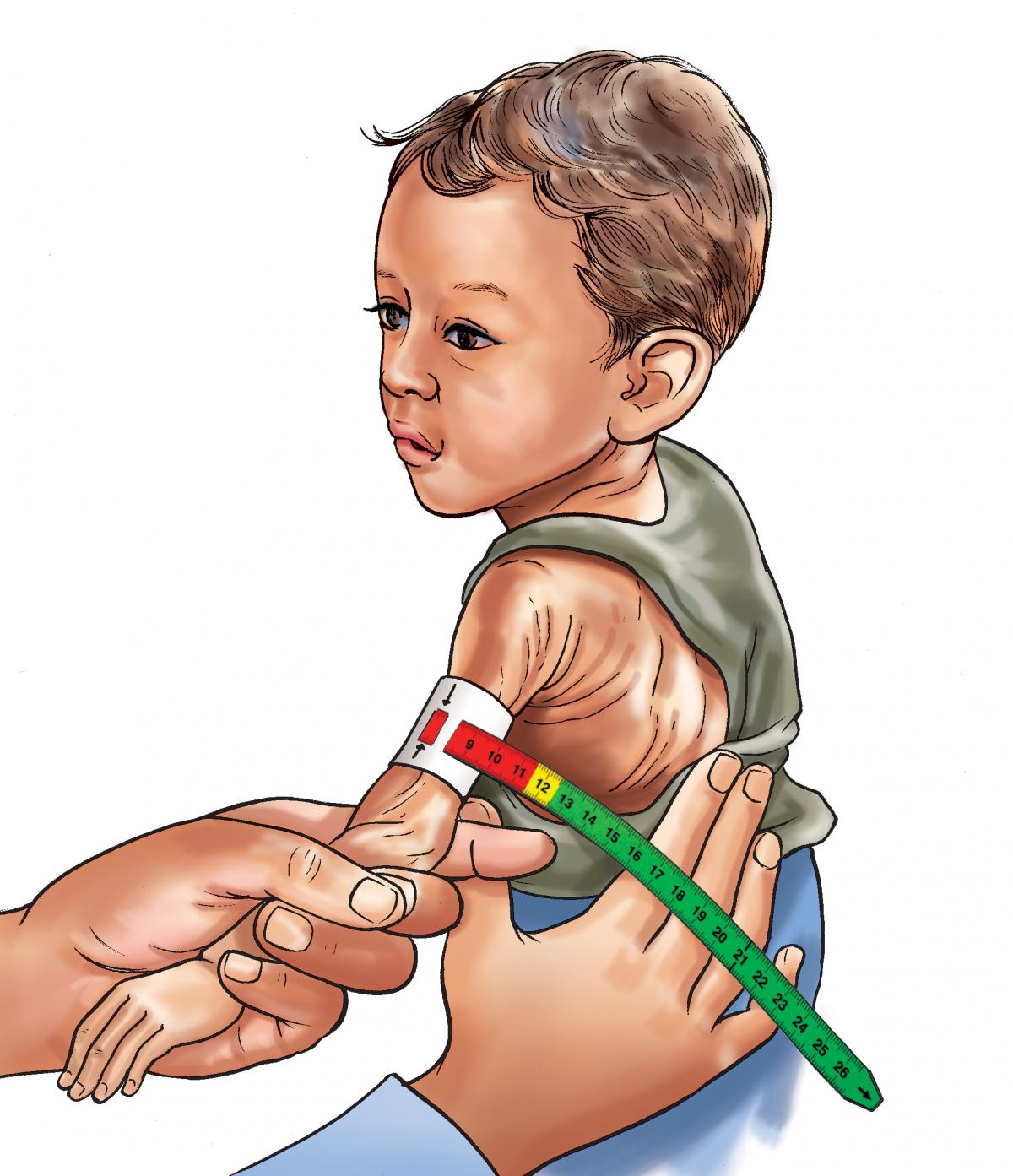 Sick Child Health - MUAC results - Severe Acute Malnutrition 0-6mo - 05 - Nepal Sick Child Health - MUAC results - Severe Acute Malnutrition 0-6mo - 05 - Nepal
