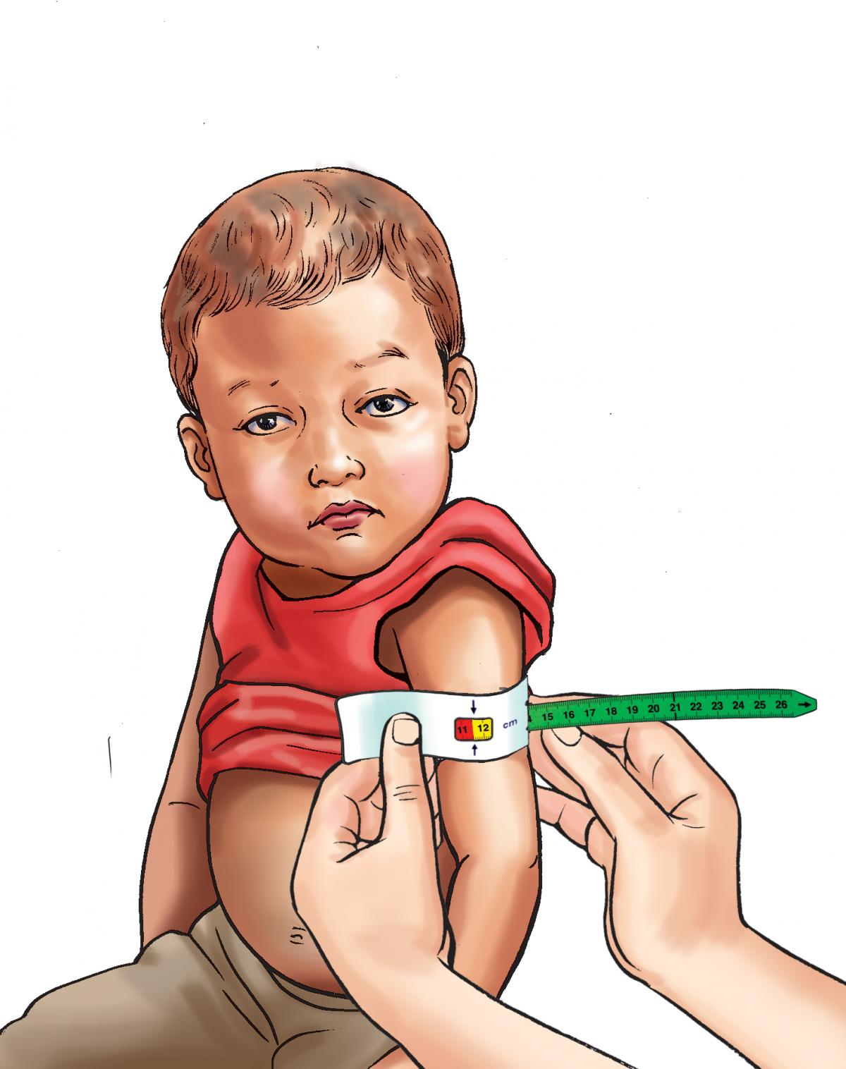 Sick Child Health - MUAC results - Moderate Acute Malnutrition 6-24 mo - 06 - Nepal Sick Child Health - MUAC results - Moderate Acute Malnutrition 6-24 mo - 06 - Nepal