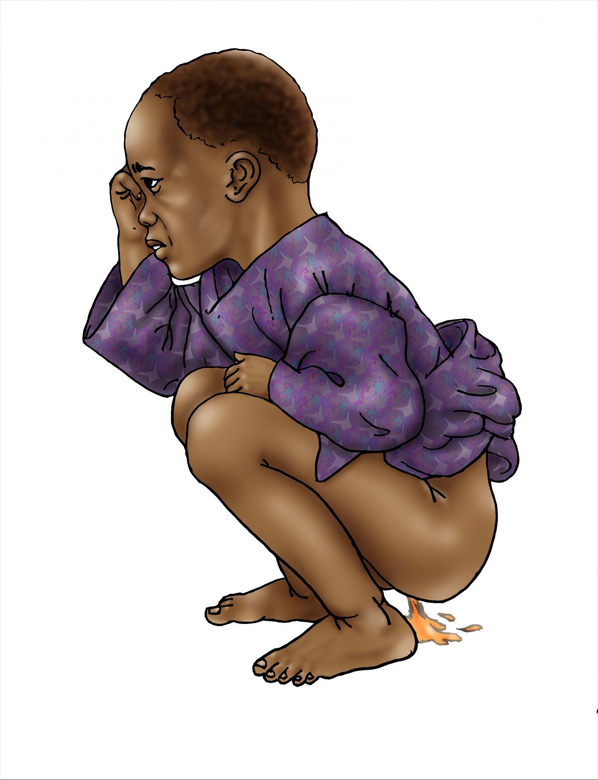 Sick Baby Health Care - Toddler with diarrhea - 00 - Non-country specific