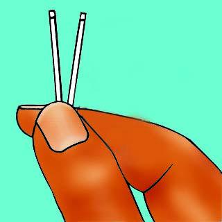 Family Planning - Birth Control - implant - 02 - Non-country specific