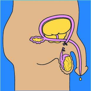 Family Planning - Male sterilization - 07 - Non-country specific