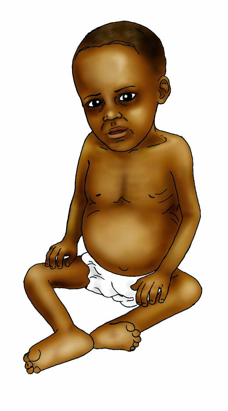 Sick Baby Health Care - Sick sitting baby 6-12 mo - 00B - Non-country specific