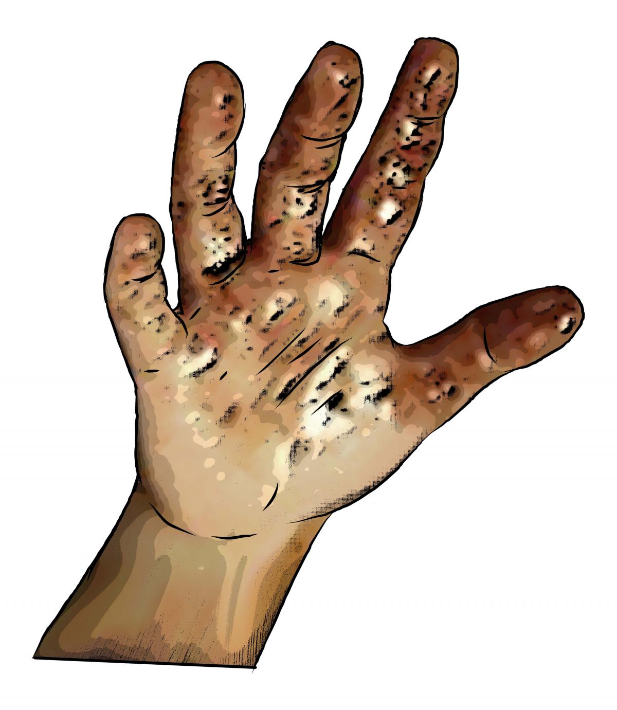Hygiene - Child's dirty hand - 00 - Nigeria